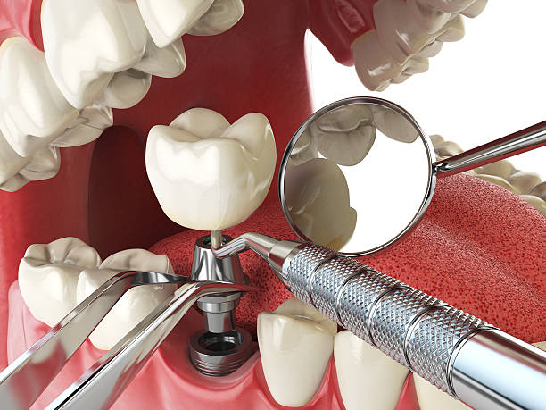 Best Emergency Root Canal Treatment in Olive Branch, MS