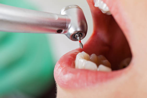 Best Emergency Treatment for Dental Infections or Abscesses in Olive Branch, MS